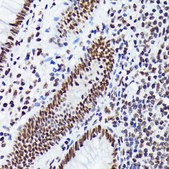 Anti-EWSR1 antibody produced in rabbit