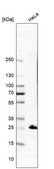 Anti-MEOX1 antibody produced in rabbit Prestige Antibodies® Powered by Atlas Antibodies, affinity isolated antibody, buffered aqueous glycerol solution