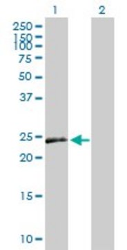 Anti-VEGFB antibody produced in mouse purified immunoglobulin, buffered aqueous solution