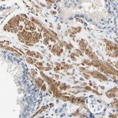 Anti-SLC27A6 antibody produced in rabbit Prestige Antibodies® Powered by Atlas Antibodies, affinity isolated antibody, buffered aqueous glycerol solution