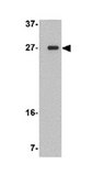 Anti-TMEM18 Antibody from rabbit, purified by affinity chromatography