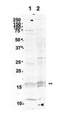 Anti-UBE2N (AB2) antibody produced in rabbit IgG fraction of antiserum