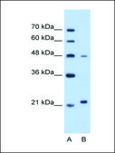 抗-MMP1 IgG fraction of antiserum