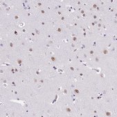 Anti-SBNO1 antibody produced in rabbit Prestige Antibodies® Powered by Atlas Antibodies, affinity isolated antibody, buffered aqueous glycerol solution