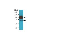 Anti-Sodium-Iodide Symporter Antibody, C-terminal 1 from rabbit