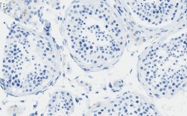 Anti-PIAS Antibody, clone 1O17 ZooMAb® Rabbit Monoclonal recombinant, expressed in HEK 293 cells