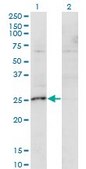 Monoclonal Anti-MIS12 antibody produced in mouse clone 1G3, purified immunoglobulin, buffered aqueous solution