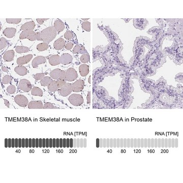 Anti-TMEM38A antibody produced in rabbit Prestige Antibodies&#174; Powered by Atlas Antibodies, affinity isolated antibody, buffered aqueous glycerol solution