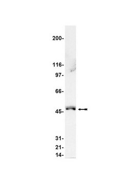 Anti-Nck&#946; Antibody Upstate&#174;, from rabbit