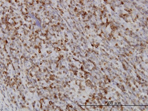 Monoclonal Anti-RAB27A antibody produced in mouse clone 1G7, purified immunoglobulin, buffered aqueous solution