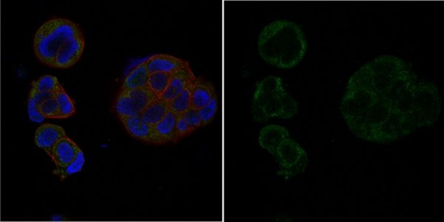 Anti-Androgen Receptor Antibody, Alexa Fluor&#8482; 488 Conjugate from rabbit, ALEXA FLUOR&#8482; 488