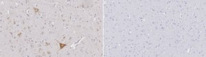 Anti-NRG1 Antibody, clone 1G5 ZooMAb® Rabbit Monoclonal recombinant, expressed in HEK 293 cells