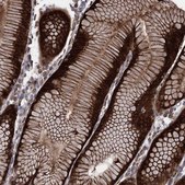 Anti-RASSF3 antibody produced in rabbit Prestige Antibodies® Powered by Atlas Antibodies, affinity isolated antibody, buffered aqueous glycerol solution