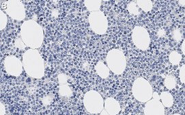 Anti-TLR4 Antibody, clone 2N20 ZooMAb® Rabbit Monoclonal recombinant, expressed in HEK 293 cells