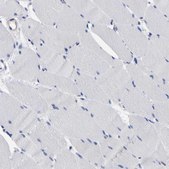 Anti-C21orf59 antibody produced in rabbit Prestige Antibodies® Powered by Atlas Antibodies, affinity isolated antibody, buffered aqueous glycerol solution, Ab1