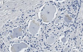 Anti-MRGPRX2 Antibody, clone 1O10 ZooMAb® Rabbit Monoclonal recombinant, expressed in HEK 293 cells