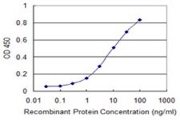 Monoclonal Anti-RAD51 antibody produced in mouse clone 4C11-B4, purified immunoglobulin, buffered aqueous solution