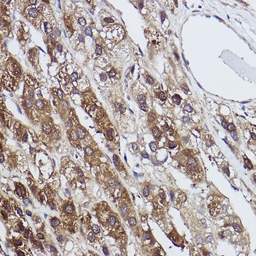 Anti-FBP1 antibody produced in rabbit