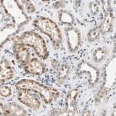 Anti-SMU1 antibody produced in rabbit Prestige Antibodies® Powered by Atlas Antibodies, affinity isolated antibody, buffered aqueous glycerol solution, Ab1