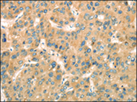 Anti-TTC23 affinity isolated antibody