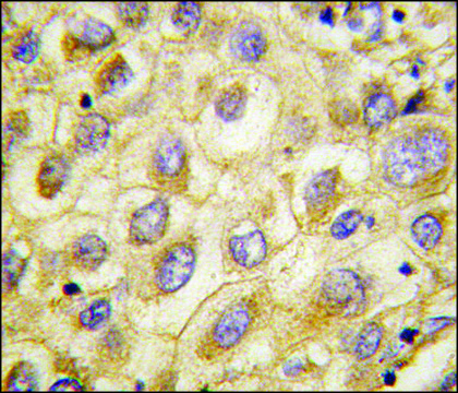 Anti-EDA (center) antibody produced in rabbit saturated ammonium sulfate (SAS) precipitated, buffered aqueous solution