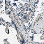 Anti-RAPGEF1 antibody produced in rabbit Prestige Antibodies® Powered by Atlas Antibodies, affinity isolated antibody, buffered aqueous glycerol solution