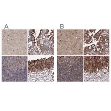 抗-DDO 兔抗 Prestige Antibodies® Powered by Atlas Antibodies, affinity isolated antibody, buffered aqueous glycerol solution