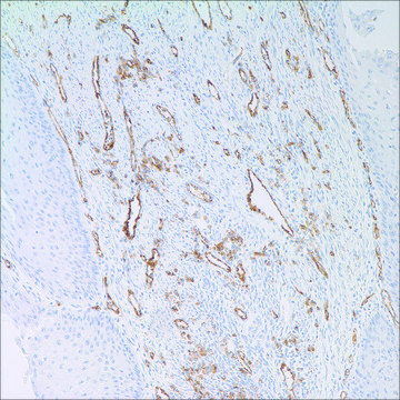 CD31 (JC70) Mouse Monoclonal Antibody