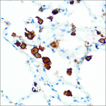 Anti-CD16A antibody, Rabbit monoclonal clone SP175, recombinant, expressed in proprietary host, affinity isolated antibody