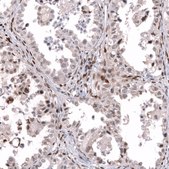 Anti-TFE3 antibody produced in mouse Prestige Antibodies® Powered by Atlas Antibodies, clone CL12810, purified by using Protein A, buffered aqueous glycerol solution