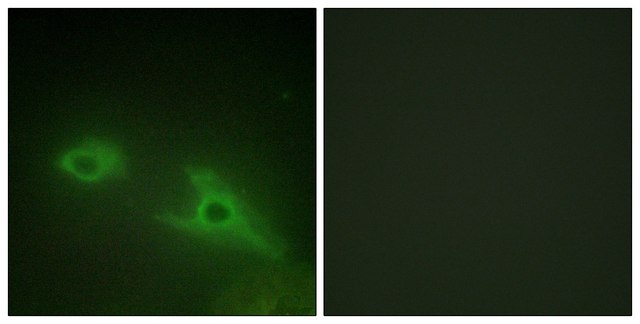 Anti-EPHA1 antibody produced in rabbit affinity isolated antibody