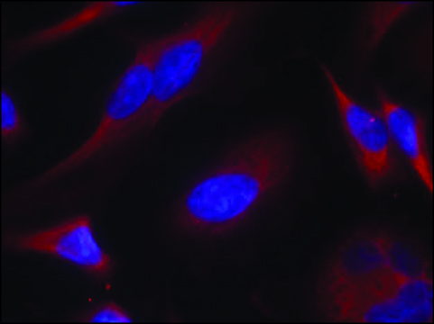 Anti-PRKD1 (Ab-738) antibody produced in rabbit affinity isolated antibody