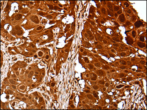 Anti-UBE2V1 affinity isolated antibody