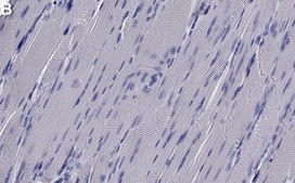Anti-Axl Antibody, clone 3D13 ZooMAb® Rabbit Monoclonal recombinant, expressed in HEK 293 cells