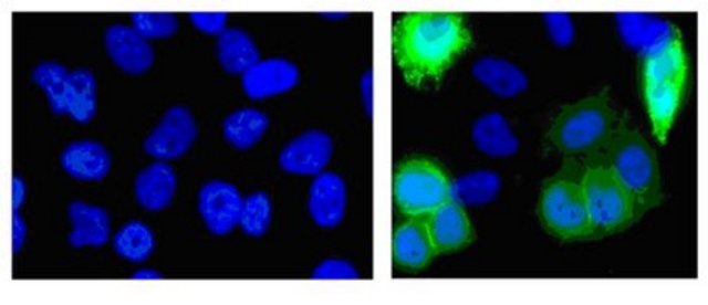 Anti-Histidine Tagged Antibody, clone HIS.H8 clone HIS.H8, Upstate&#174;, from mouse