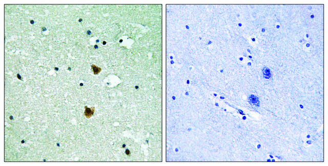 Anti-HSP27 antibody produced in rabbit affinity isolated antibody