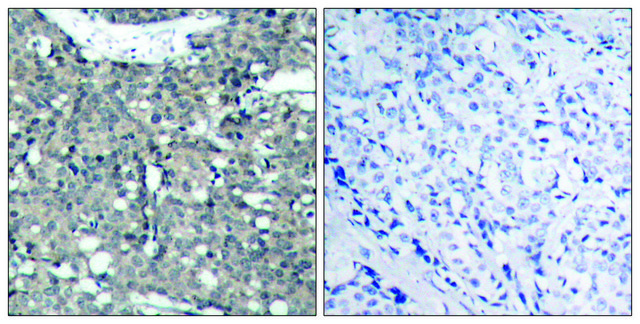 Anti-Paxillin antibody produced in rabbit affinity isolated antibody