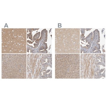 Anti-MPRIP antibody produced in rabbit Prestige Antibodies&#174; Powered by Atlas Antibodies, affinity isolated antibody, buffered aqueous glycerol solution, Ab2