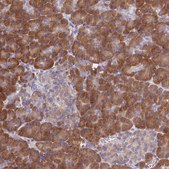 Anti-HM13 antibody produced in rabbit Prestige Antibodies® Powered by Atlas Antibodies, affinity isolated antibody, buffered aqueous glycerol solution