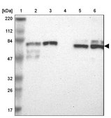 Anti-TRIM25 antibody produced in rabbit Prestige Antibodies® Powered by Atlas Antibodies, affinity isolated antibody, buffered aqueous glycerol solution