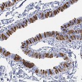 Anti-TPPP3 antibody produced in rabbit Prestige Antibodies® Powered by Atlas Antibodies, affinity isolated antibody, buffered aqueous glycerol solution