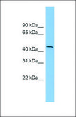 Anti-DPH1, (N-terminal) antibody produced in rabbit affinity isolated antibody