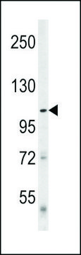 ANTI-DENATURED ATG1 antibody produced in rabbit purified immunoglobulin, buffered aqueous solution