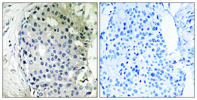 Anti-ARHGEF10 antibody produced in rabbit affinity isolated antibody