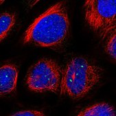 Anti-NAA40 antibody produced in rabbit Prestige Antibodies® Powered by Atlas Antibodies, affinity isolated antibody, buffered aqueous glycerol solution