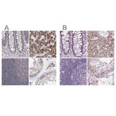 Anti-ACOX2 antibody produced in rabbit Prestige Antibodies® Powered by Atlas Antibodies, affinity isolated antibody, buffered aqueous glycerol solution
