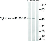 Anti-Cytochrome P450 2J2 antibody produced in rabbit affinity isolated antibody