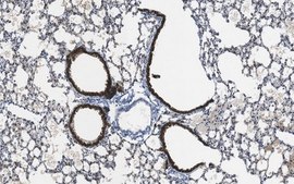 Anti-Cytokeratin 8 Antibody, clone TROMA-1 clone TROMA-1, from rat