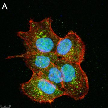 Anti-SIRT6 Antibody, clone 1O6 ZooMAb&#174; Rabbit Monoclonal recombinant, expressed in HEK 293 cells