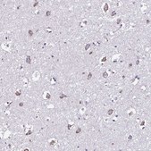 Anti-RNFT2 antibody produced in rabbit Prestige Antibodies® Powered by Atlas Antibodies, affinity isolated antibody, buffered aqueous glycerol solution